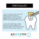 퍼즐치과기공소 이미지