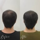 안산문신 이미지