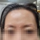 장안로25번길 | 분당눈썹잘하는곳 뷰티눈썹 분당 눈썹 반영구 후기