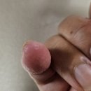 천연비누사랑어머니회 | 피부 가려움증 치료, 98% 천연유래 포라트 리온 비누 후기로 본 올인원 비누의 정석