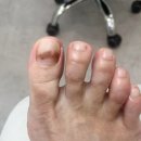 헬리오 명품세탁소 | 푸스케어 송파석촌점, 여름 쪼리 신기 전에 발톱 관리받고 온 후기