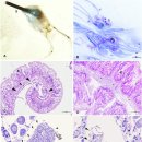 지중해 서식 보라성게(Paracentrotus lividus) 가시탈락증의 Vibrio splendidus 이미지