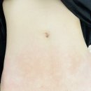 병점 피부관리 전신관리 비포애프터 후기 대박 예디드뷰티