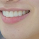 미소연치과의원 이미지