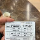 스마일 | 울산 신세계안과 스마일프로 후기 : )
