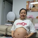 [임신출산] 10달의 기다림 분당제일여성병원 제왕절개 4박5일 후기