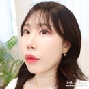 M-스킨케어 | 강남역 피부과 물광주사 릴리이드M 스킨부스터 솔직후기