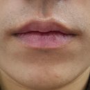 더젠의원 | [뷰티/강남] 강남 세라미크 의원 수염🧔 레이저 제모 | 남자 레이저제모 | 수염 제모 | 남자 제모...