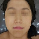 신동아대원(아) | 수원에스테틱 권선에스테틱 도도스킨앤바디 얼굴 소멸되는 관리 후기 (수분관리 3만원/재생관리 5만원)