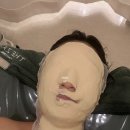 씨유 위례에이플타워점 | 위례피부관리 더작 위례점 조형윤곽관리로 작은얼굴 성공 후기