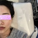 삼층약국 | 남포동 피부관리 압출 잘하는곳 신부관리 하베레피부전문센터