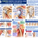 “어깨 움직임은 살리고 안정성은 높이는 키네시올로지 테이핑” 이미지