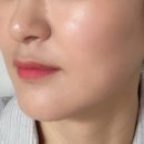 필스토리의원 이미지