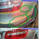 덴트렉스 이미지