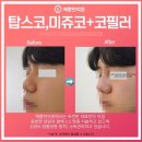 테스코
