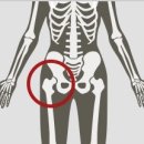 골다공증 환자에게 도움이 되는 운동은? [ 부산정형외과추천 , 개금정형외과추천 ]