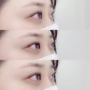 블링you