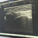 BYC빌딩 | 발목인대파열 수술 진주 본병원 / 본병원 5과 / 진주 오픈캐스트 open cast / 순천 영조물 배상 공제 후기