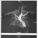 Surgery of the Aortic Arch 이미지