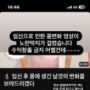 해쭈 임신후 몸변화 유튜브 노딱 받음 이미지