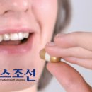 캡슐