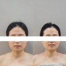 타미나 | 대구 서구 윤곽관리 추천, 타미나다 에스테틱 솔직 후기