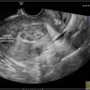 하산부인과의원 이미지