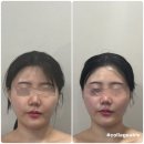 문정역피부관리 주피에뜨 에스테틱 완전 강추 후기