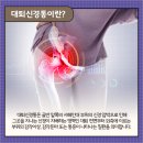 분당서울재활의학과의원 네이버블로그