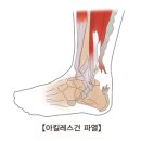 발로만 이미지