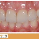 군산치과기공소 이미지