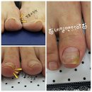 네일아이(nail eye)