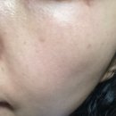 (주)감소프트 | 저자극 서화비 소프트 페이셜 필링 솔직 사용후기