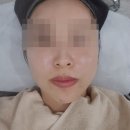 제이와이 아카데미 | [대구 제이와이뷰티] 대구 수성구피부관리 시원한두피관리 시지여드름흉터 관리후기