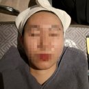 유앤아이 건대점, 3월 첫방문 이벤트 아쿠아필 보톡스 솔직후기