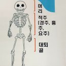 일반골절과 5대골절 이미지