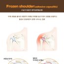 힘찬한의원 이미지