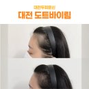 헤어바이림 | 대전두피문신 자연스러운 보정 대전 도트바이림