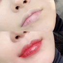 닥터브로우 이미지