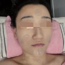 더그린에너지플러스 | 대구 피부관리 신부 웨딩케어 라플러스에스떼 윤곽관리 물방울 후기