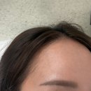 미헤어라인 - 철원군 | 부평역왁싱 후기｜미무드에서 헤어라인·이마 왁싱 받고 온 솔직 후기