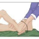 첨족 보행[tiptoe walking] 이미지