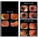 반석내과영상의학과의원 | 위내시경 대장내시경검사 : 대전 반석동 반석내과영상의학과의