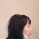 카페모들 3호점 | 50대 여성 정수리 탈모, 두피문신 부작용 두피생장술 1달 과정 공유