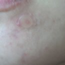 봄메디케어 이미지