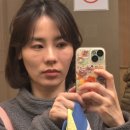 강남뷰티업성형외과 | 강남역성형외과 리쥬란 솔직후기 리쥬란힐러 4cc + 리쥬란아이 엠보없고 통증적은 시술이라고?