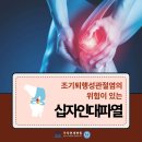 십자인대파열 통증이 심하지 않아도 병원에 꼭 가야 할까요? 이미지