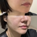 일산 웨딩케어 더맑은스킨 일산장항점 후기