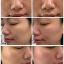 제이앤에이치 솔루션 | 💆🏻‍♀️ 제이콤마 피부앤왁싱 │ 알테온 피부관리 체험 후기 │ 울산 남구 삼산동