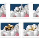 찬치과기공소 이미지